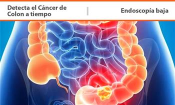 Colonoscopia incluye Informe descriptivo y grafico con Konexxion Medica