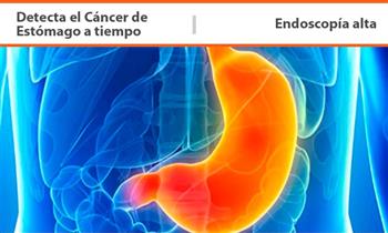 Endoscopia Alta incluye Informe descriptivo y grafico del procedimiento