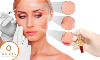 ¡Recupera la juventud y vitalidad de tu rostro! con el plasma Rico en Plaquetas en OKARA