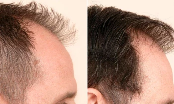 Microblading 9D para cejas