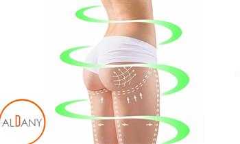 10 visitas de carboxiterapia en cuerpo completo