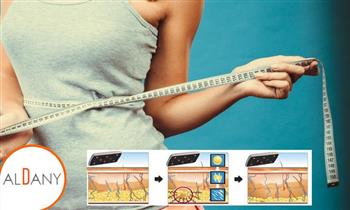 Lipolaser en 6 sesiones carboxiterapia y mas