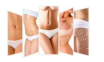 ¡Reduce medidas! Tratamiento reductor con lipolaser hidrolipoclasia carbo y mas