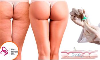 Vitamina C endovenosa Plasma Rico en Plaquetas y mas