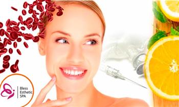 Vitamina C endovenosa Plasma Rico en Plaquetas con opcion a electroporacion y mas