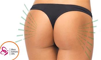Butty lift con Peptonas radiofrecuencia ondas rusas y mas