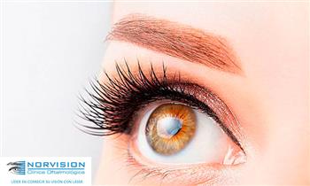 Cirugia Excimer laser en ambos ojos en Norvision