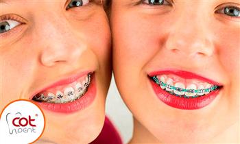 Brackets esteticos o metalicos blanquemiento y mas