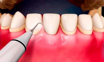 Microblading 9D para cejas