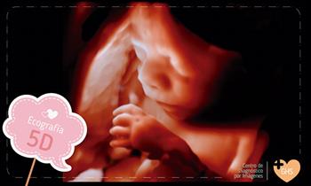Ecografia Doppler color obstetrica o genetica o morfolofica y mas en GHS