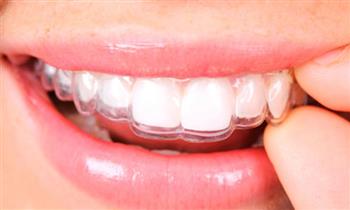Ferula de Relajacion Profilaxis Curacion 3M y Mas en Dental Center