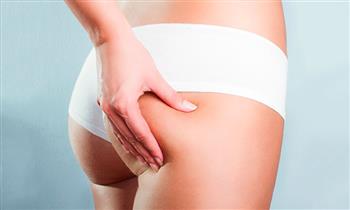 6 visitas de anticelulitis focalizada en gluteos y piernas en Maliz