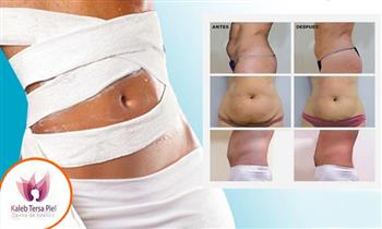 Yesoterapia en 2 ses con lipolaser ondas rusas Crioreafirmante y mas