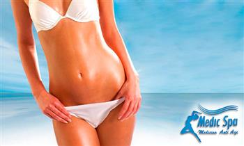 Tratamientos de Lipoescultura sin cirugia en abdomen cintura y mas