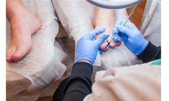 ¡Pies sanos! Tratamiento podologico Profilaxis podal 5 sesiones de laser