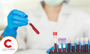 Analisis clinicos Chequeo preventivo de salud consulta medica