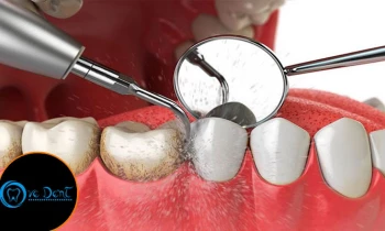 Microblading 9D para cejas