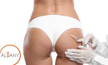 Levantamiento de gluteos en 3D Peptonas Termoterapia Radiofrecuencia y mas
