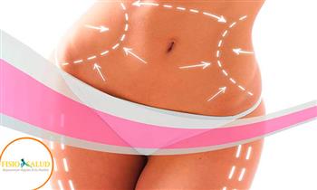 5 sesiones de reduccion de abdomen completo ¡Reduce hasta 7 cm! con Fisiosalud