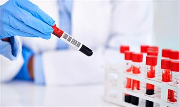 Analisis clinicos Paquete de salud consulta medica