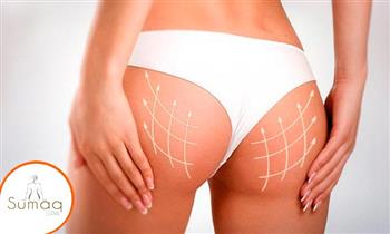 2x1 Gluteos 3D Sesion de Peptonas Vitamina C y mas