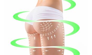 ¡Preparate para el verano! Aplicacion de peptona vacumterapia y mas en A&C San Borja