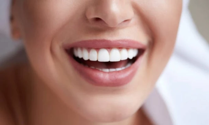 2 Sesiones de Blanqueamiento dental LED + diagnóstico + odontograma + profilaxis y más.
