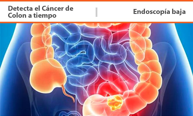 Centro de diagnostico colonoscopia