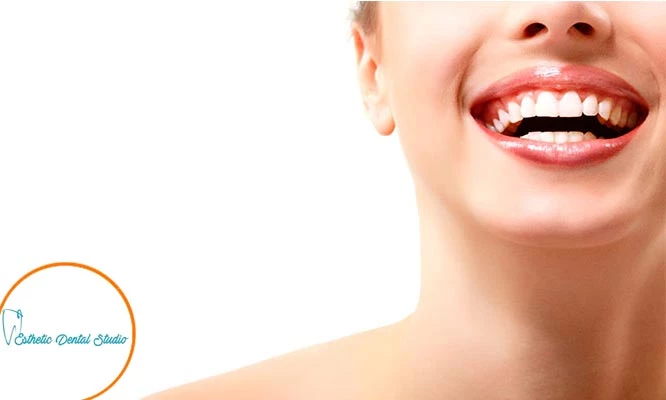 Paquete de limpieza profunda y blanqueamiento con destartaje y más