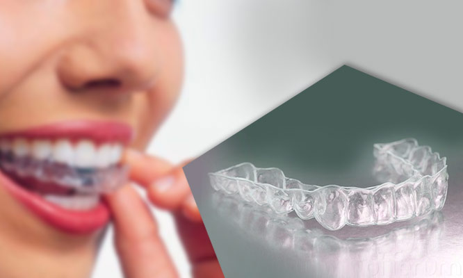 Ferula miorelajante y de proteccion fluorizacion Odontograma completo y mas