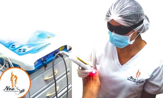 Lince 4 5 o 6 sesiones de laser antihongos en ambos pies y mas