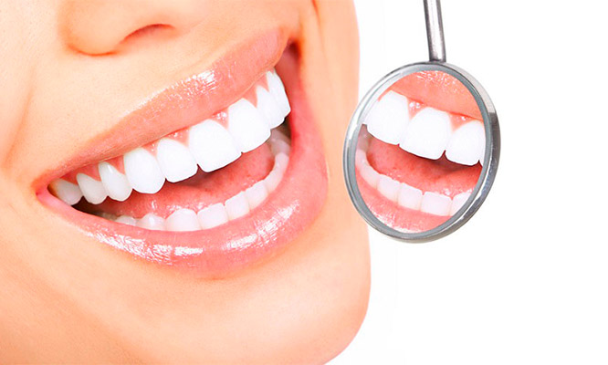 Blanqueamiento dental 4 o 6 curaciones odontograma y mas