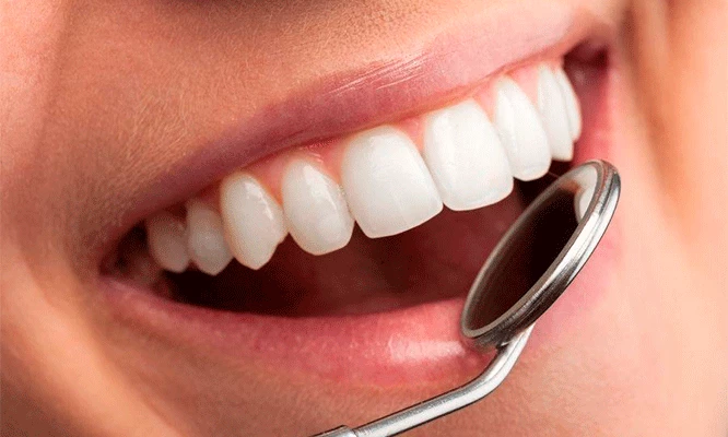 LIMPIEZA DENTAL (DESTARTRAJE) en Miraflores