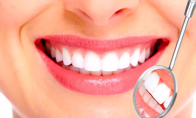 blanqueamiento dental 3 sesiones + fisioterapia bucal y más