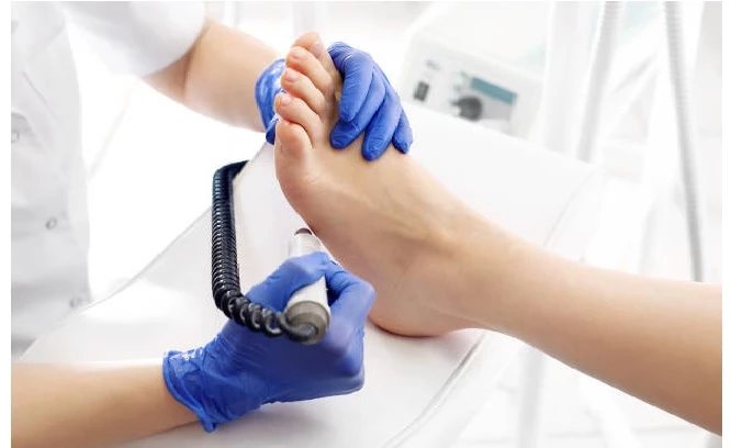 5 o 6 sesiones de láser + podología integral y más