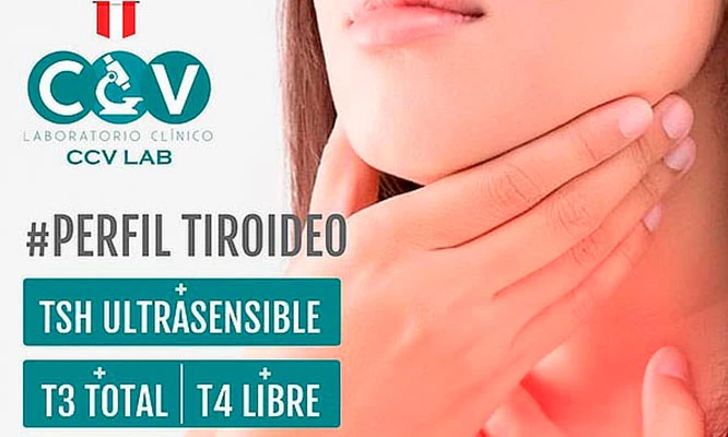 Perfil Tiroideo + TSH Ultrasensible + T3 Total + T4 Libre
