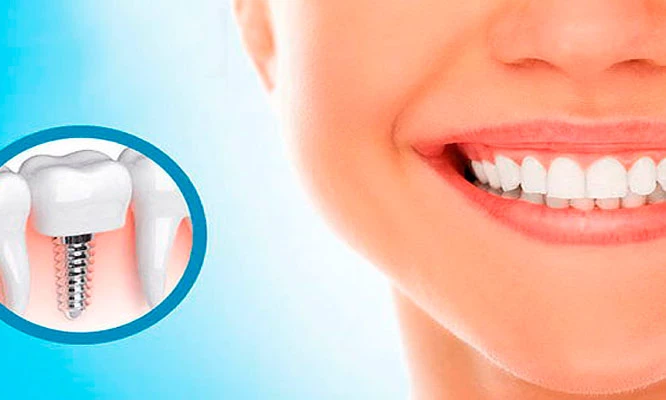 Paga S/ 69 con nosotros y S/900 en Virtual Dent.